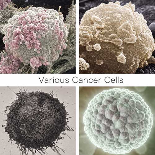 various cancer cells