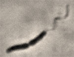 helicobacter pylori